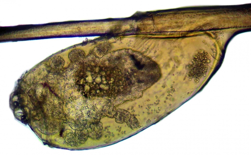 Гнида под микроскопом